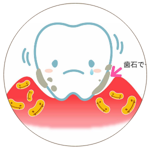 予防歯科 高崎市スマイル歯科クリニック