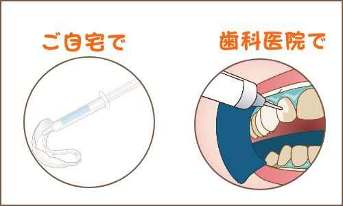 ホワイトニング２種類