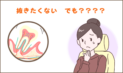 抜きたくない