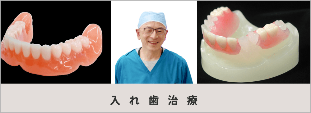 入れ歯治療