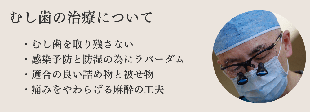 むし歯治療について