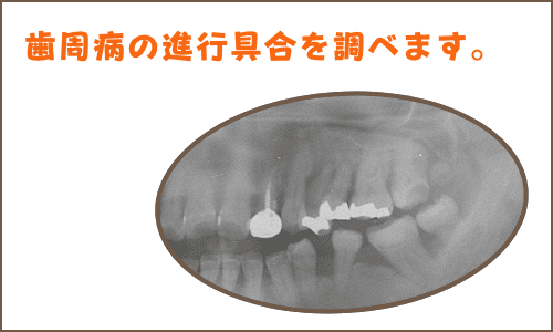 レントゲン