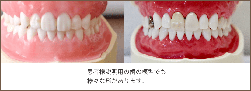 歯の模型