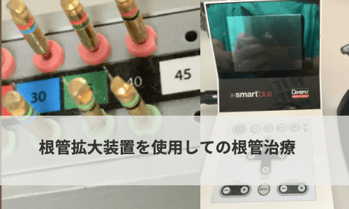 根管拡大装置スマートプラス