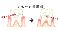 怖い歯周病