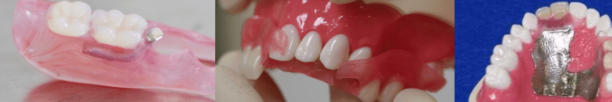 自由診療入れ歯