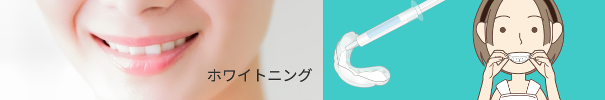 ホワイトニング
