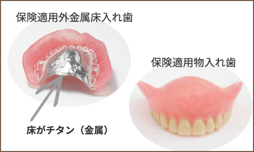 保険義歯と保険外義歯