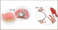 保険と保険外の入れ歯