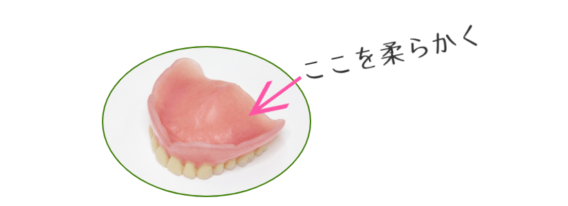 柔らかい入れ歯