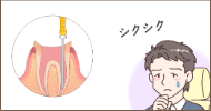 根管治療まだシクシク