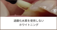 ホワイトニング