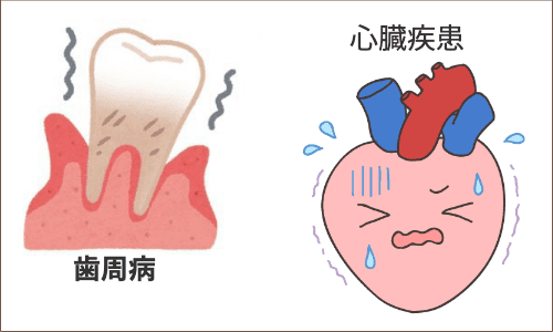 歯周病と心臓疾患